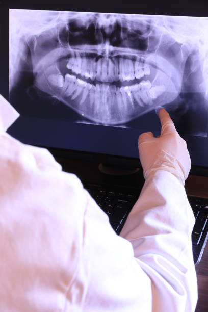 Best Holiday Emergency Dentist in Harvey, ND