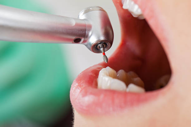 Best Emergency Dental Services for Seniors in Harvey, ND